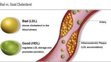 What Is Serum Cholesterol and Why Is It Important? | Vitasell.net
